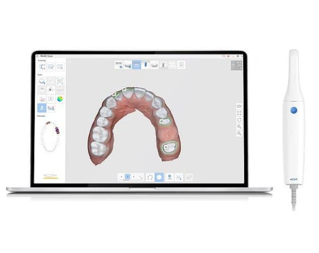 Диагностика с помощью интраорального 3D сканера Medit I500 