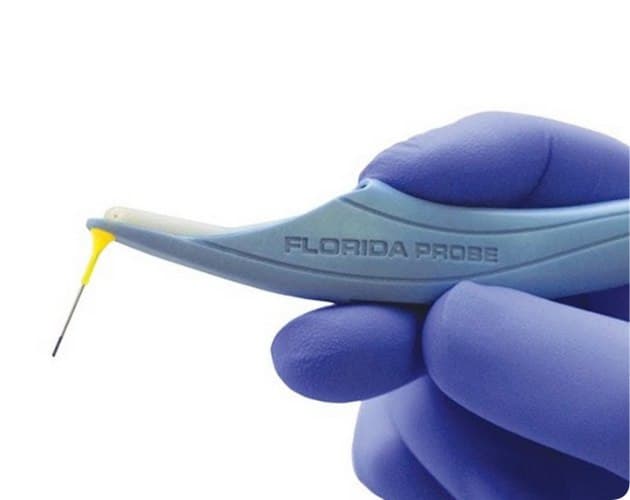 Диагностика болезней десен аппаратом «Florida Probe»