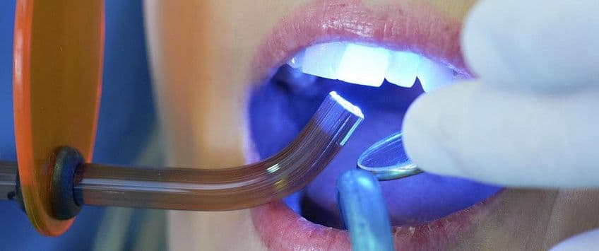 Реставрация коронки зуба 