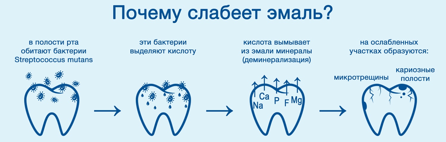 Реминерализация и фторирование зубов 